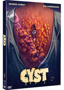 Cyst |   DVD